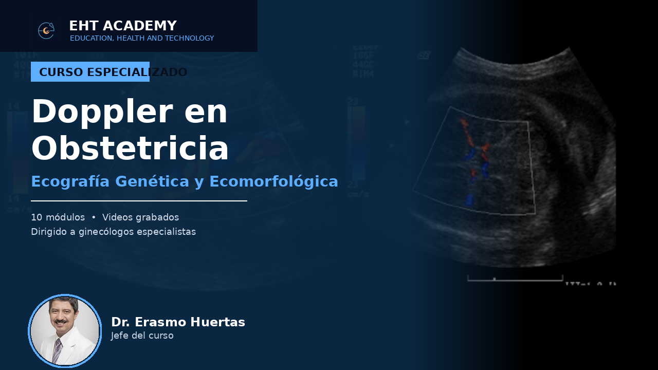 Doppler en Obstetricia